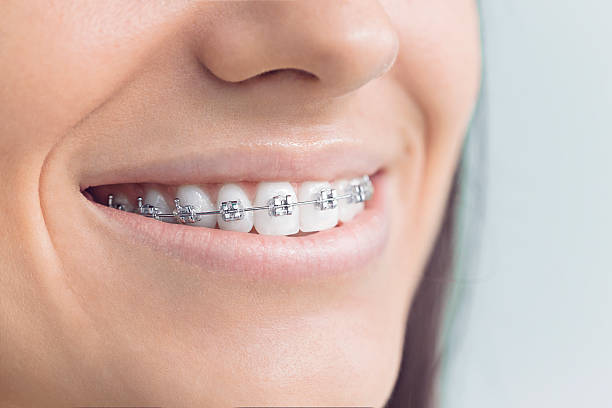 Best Wisdom Tooth Removal  in Palmer, AK
